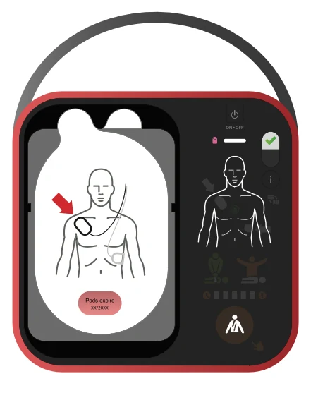 Open Public Access AED illustration